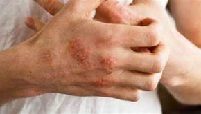 Psychological Assessment